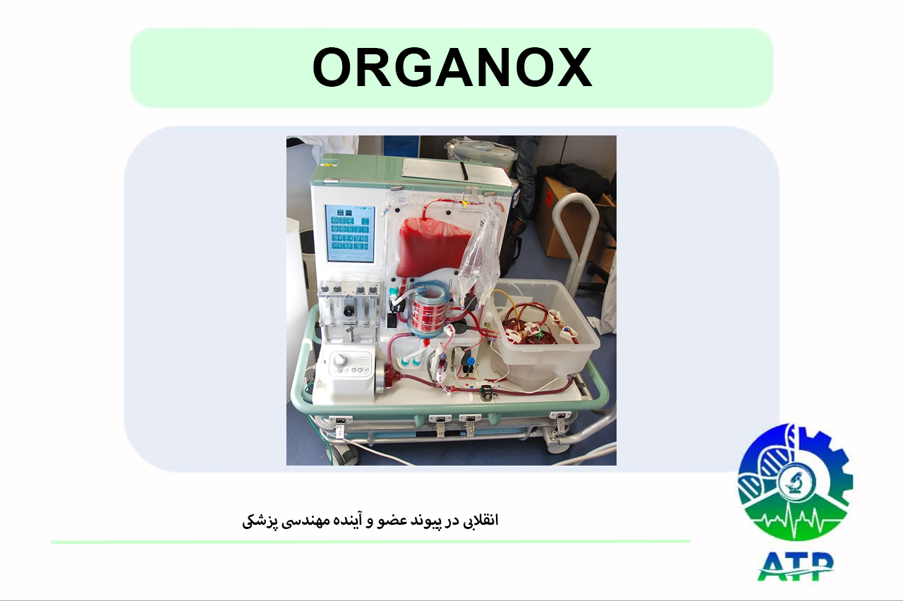 «فناوری OrganOx تحول بزرگی در حوزه پیوند عضو ایجاد کرده است. این مقاله به بررسی سازوکار دستگاه، نقش مهندسی پزشکی، نمونه‌های موفق جهانی و ..