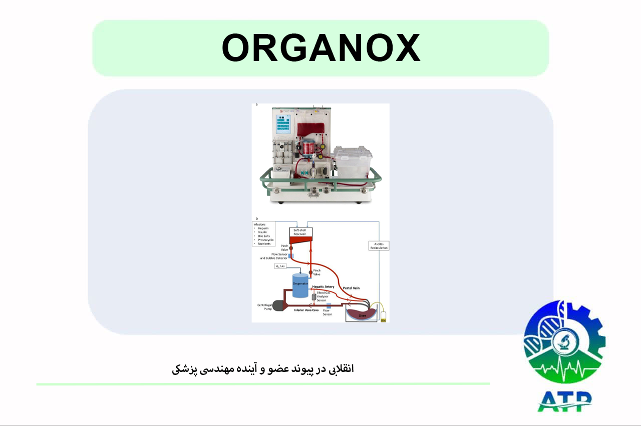 «فناوری OrganOx تحول بزرگی در حوزه پیوند عضو ایجاد کرده است. این مقاله به بررسی سازوکار دستگاه، نقش مهندسی پزشکی، نمونه‌های موفق جهانی و ..